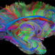 Illustration for article titled Amazing DSI Brain Scanning Visualizes Your Minds Inner Workings In 3D